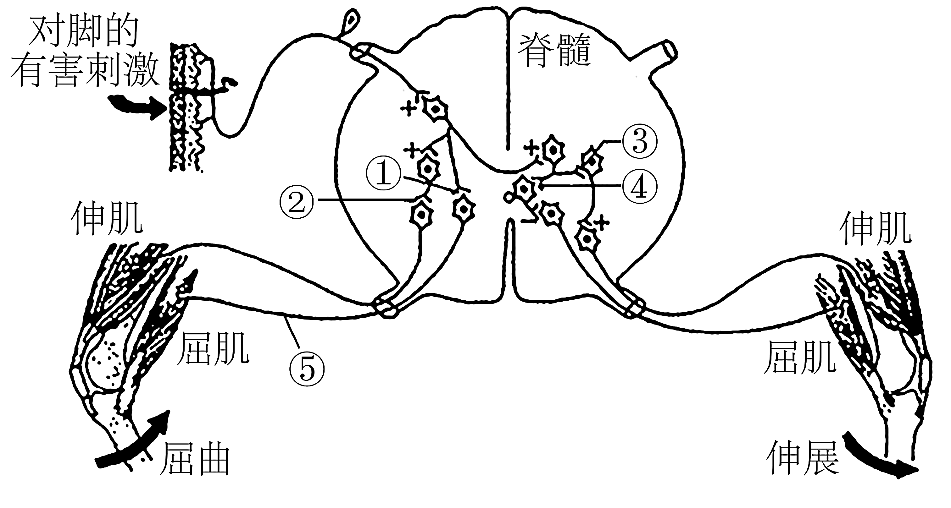 a如果此反射弧结构中脊髓被破坏,则小明的屈曲反射不能发生b据图分析