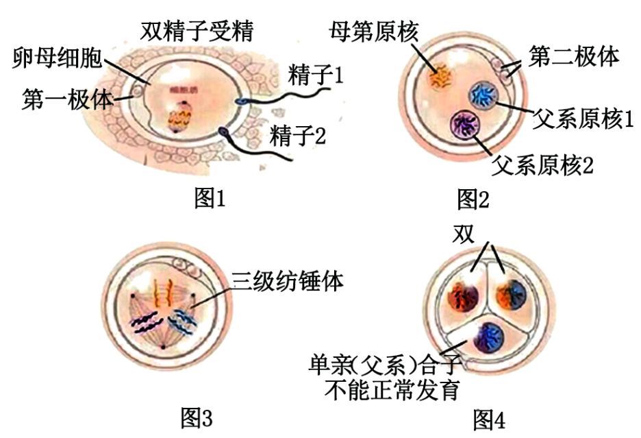 (一)双胞胎奇谈,澳大利亚布里斯班一对半同卵双胞胎-高途